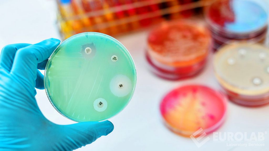 Test di efficacia del conservante antimicrobico