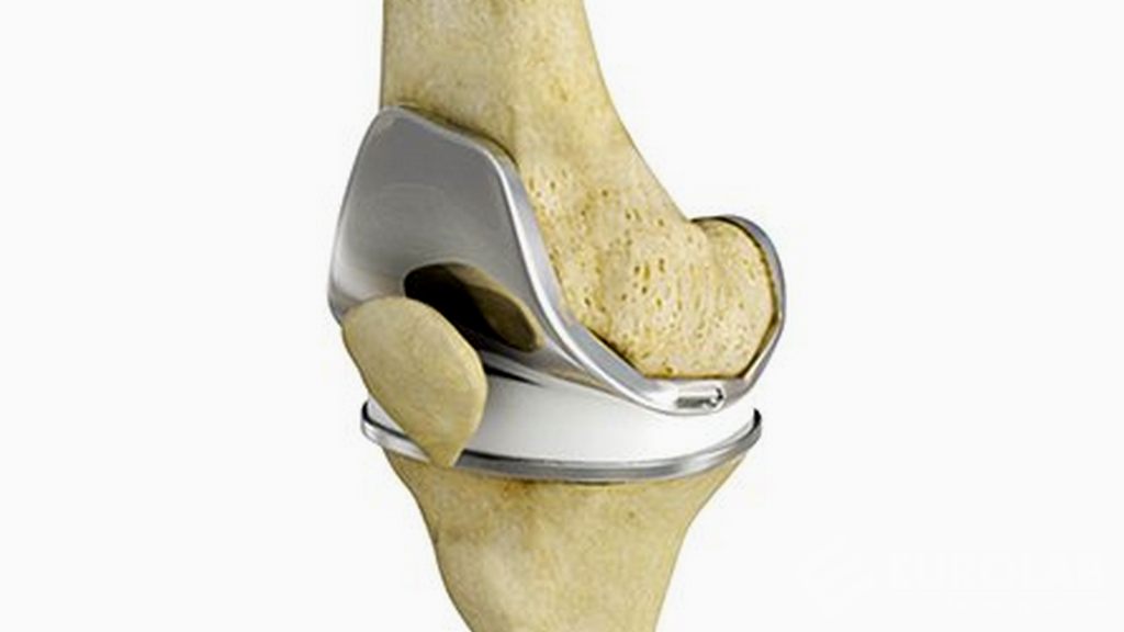 ASTM F2996 Test dello stelo femorale dell'anca