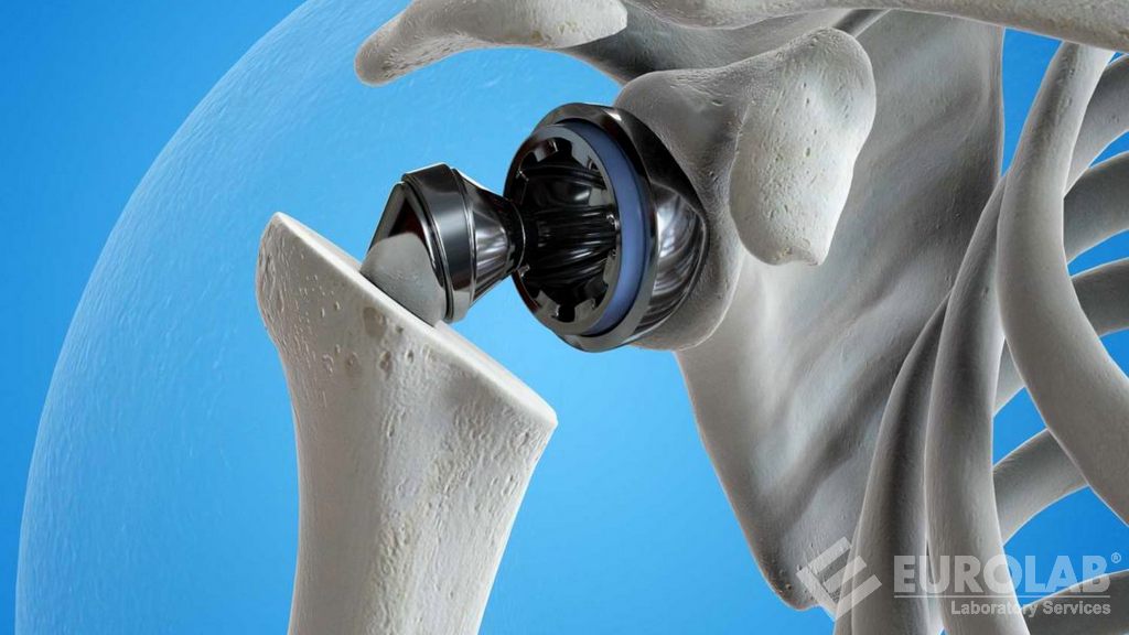 Eklem Replasman İmplantları için Özel Gereklilikler ISO 21534