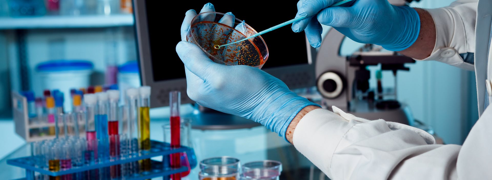 Agar Yaması Antimikrobiyal Kalıcılık Testi