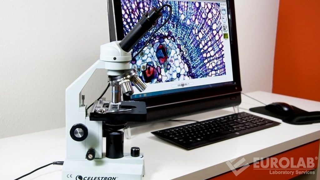 광학 현미경 분석