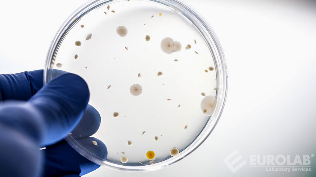 تست ضد میکروبی پانسمان های تحت درمان